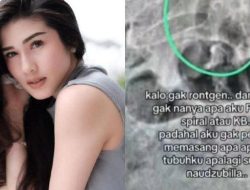 Selebgram Stevie Agnecya Meninggal Dunia: Cerita Perjalanan Terakhir dan Ucapan Perpisahan